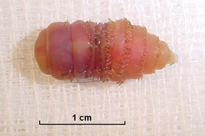 bot fly larvae human skin