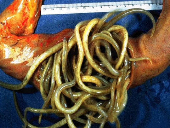 roundworms in humans